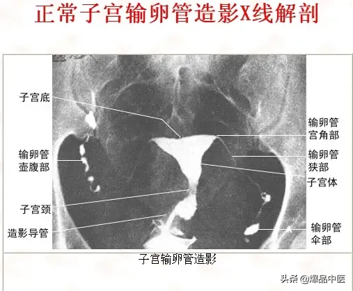 正常Ｘ线解剖