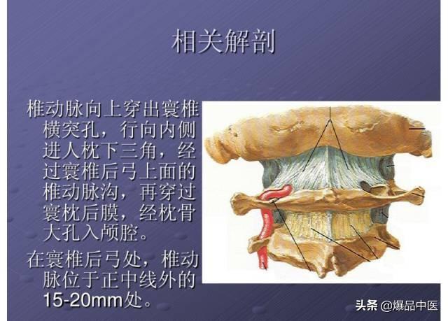 颈项部肌肉基础解剖——起止点及作用