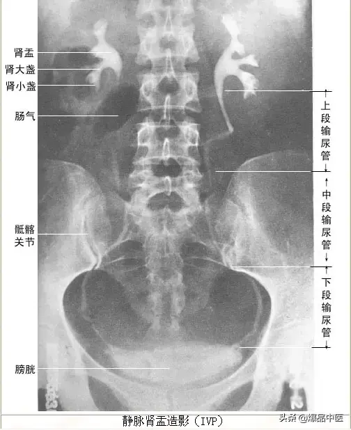 正常Ｘ线解剖