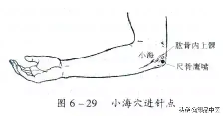 关节穿刺技巧「髋、膝、踝、肩、肘、腕」