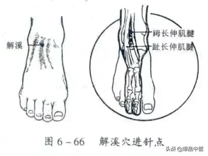 关节穿刺技巧「髋、膝、踝、肩、肘、腕」