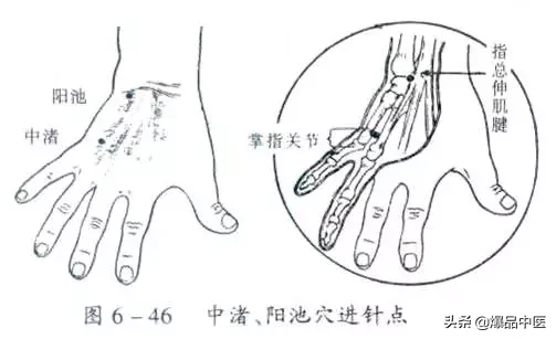 关节穿刺技巧「髋、膝、踝、肩、肘、腕」