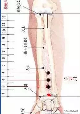 图解董氏七十二绝针，一目了然