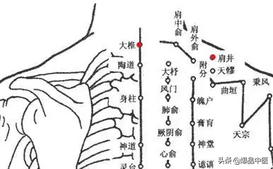 各种痛症的针灸治疗(值得收藏)