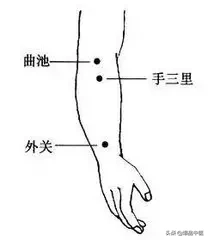 各种痛症的针灸治疗(值得收藏)