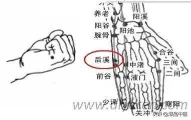 各种痛症的针灸治疗(值得收藏)