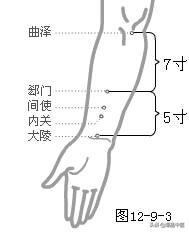 各种痛症的针灸治疗(值得收藏)