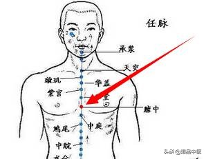 各种痛症的针灸治疗(值得收藏)