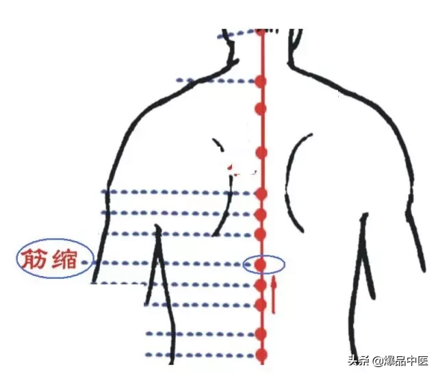 图解88个精选穴，一穴一用