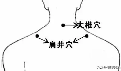 图解88个精选穴，一穴一用