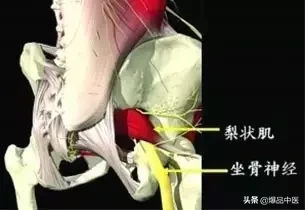 骨神经痛图解