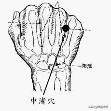 各种痛症的针灸治疗(值得收藏)