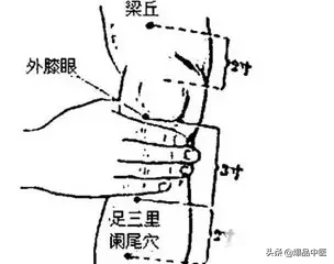 各种痛症的针灸治疗(值得收藏)