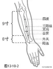 各种痛症的针灸治疗(值得收藏)