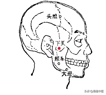 各种痛症的针灸治疗(值得收藏)