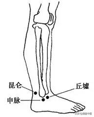 各种痛症的针灸治疗(值得收藏)