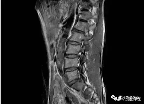 「专业篇」超级实用的腰腿痛临床诊断思维，值得收藏