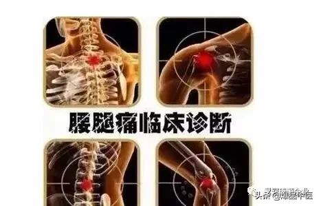 「专业篇」超级实用的腰腿痛临床诊断思维，值得收藏