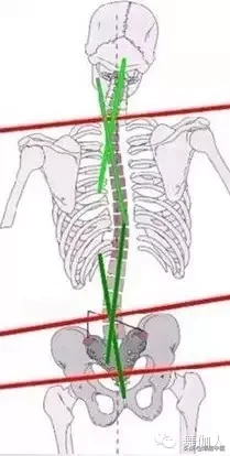 为什么会有高低肩！长短腿？