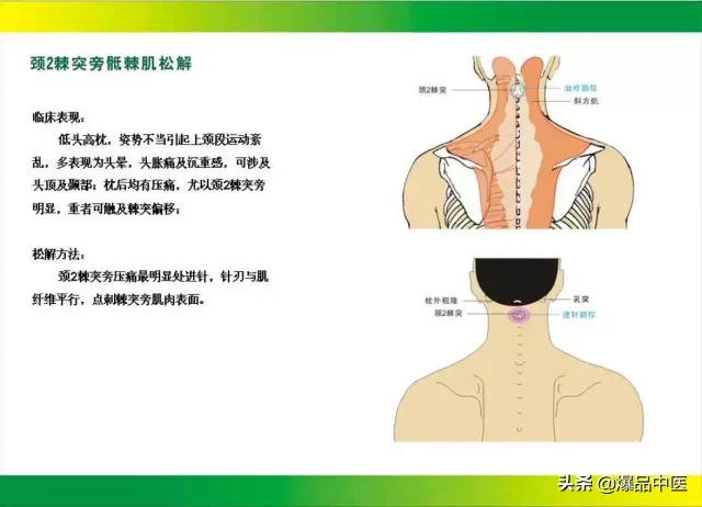 针刀治疗图解