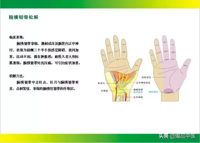 针刀治疗图解