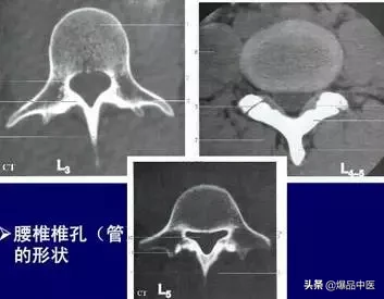 详细的脊柱腰段解剖图