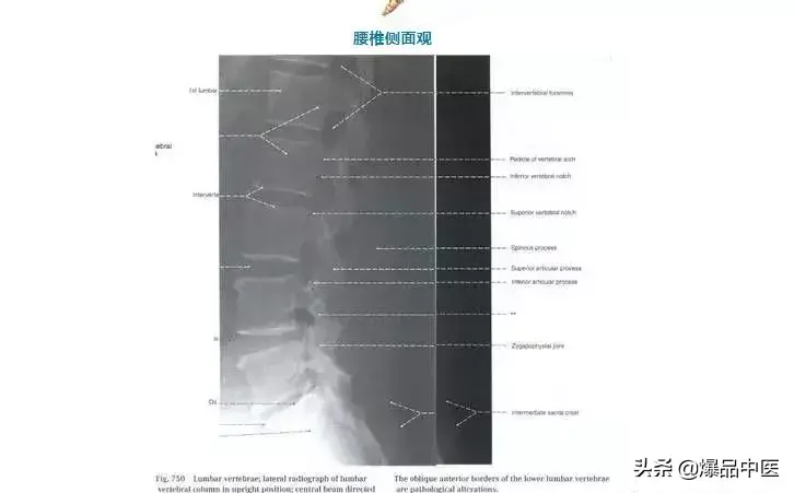 详细的脊柱腰段解剖图