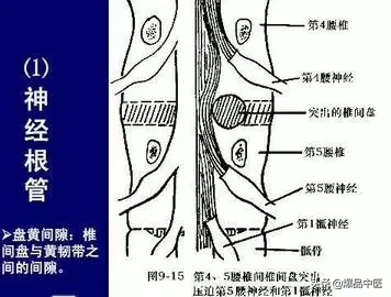 详细的脊柱腰段解剖图