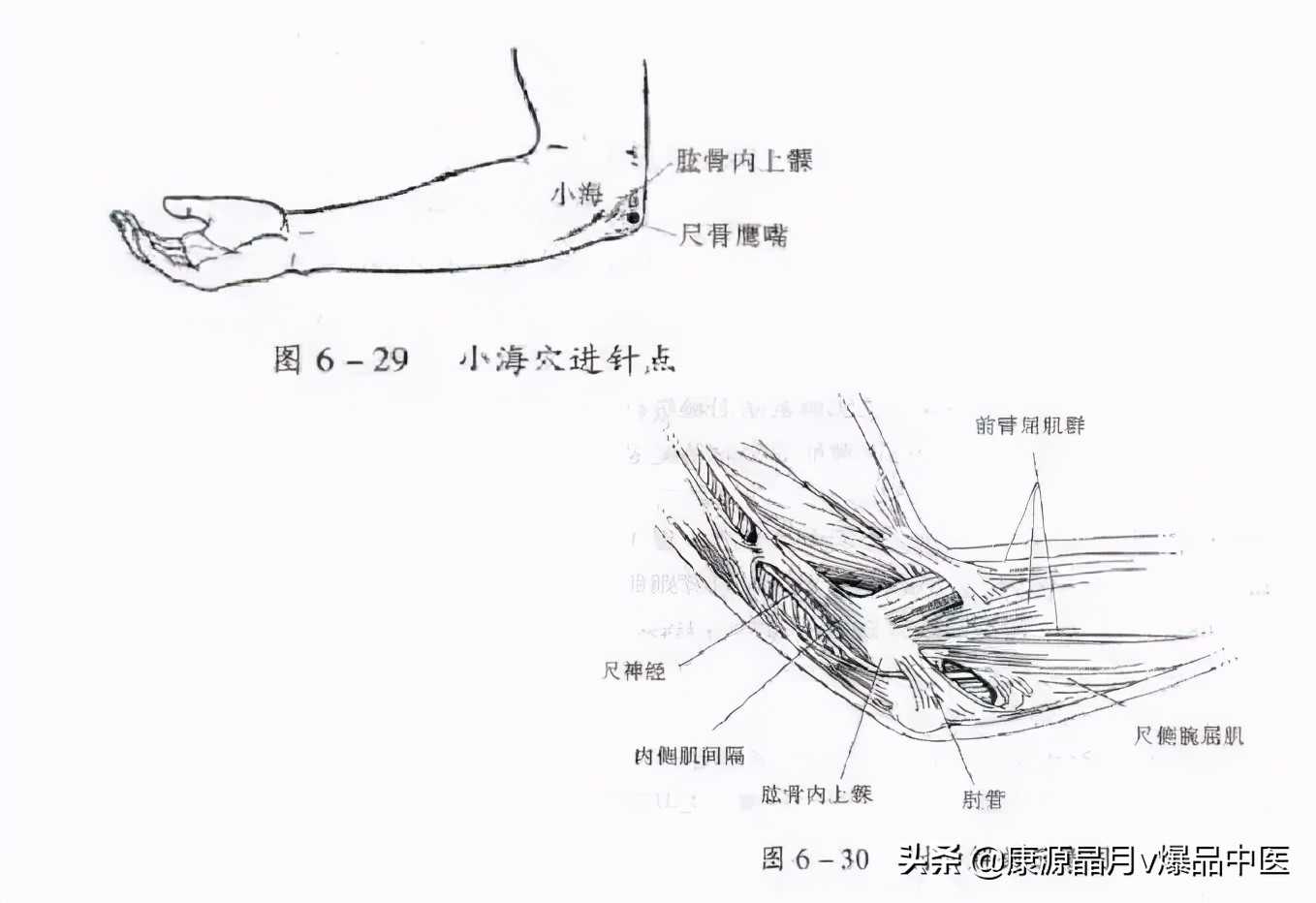 常用关节腔穿刺方法技巧大全