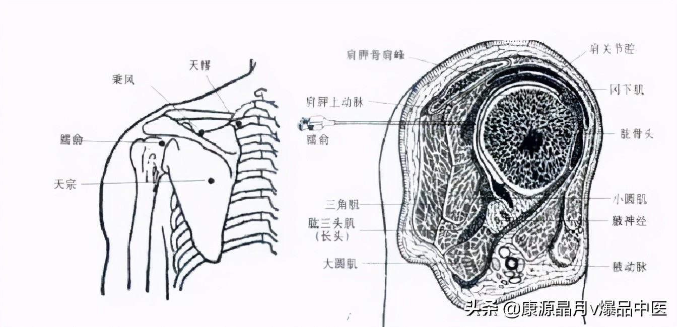 常用关节腔穿刺方法技巧大全