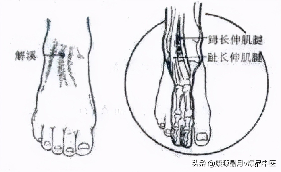 常用关节腔穿刺方法技巧大全