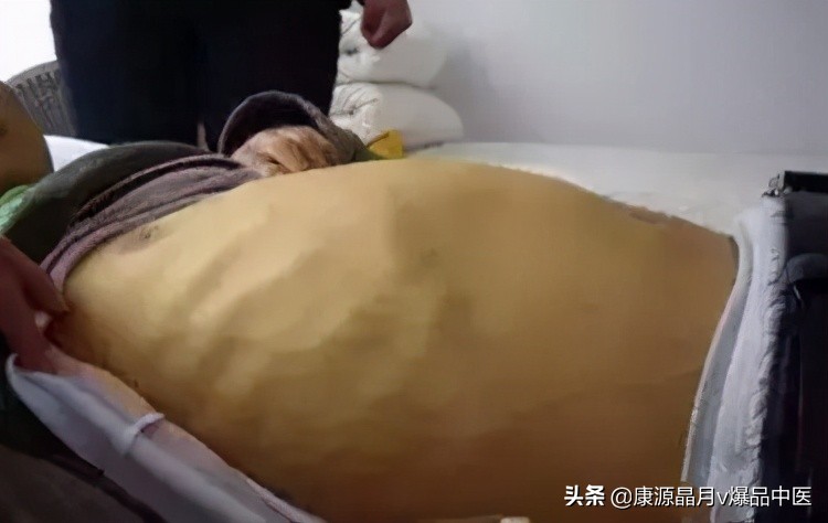 这个部位长青筋，非死即残