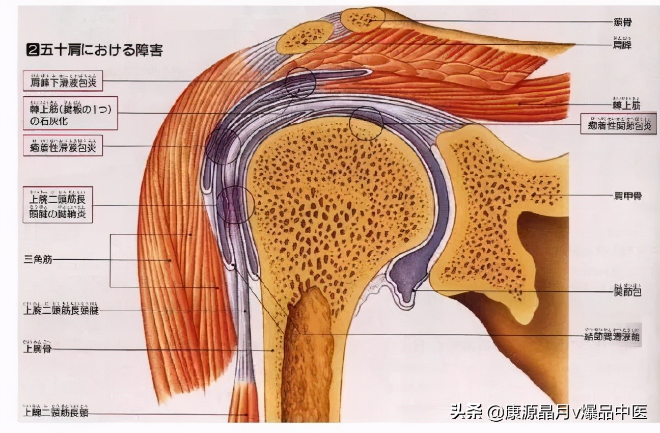 常用关节腔穿刺方法技巧大全