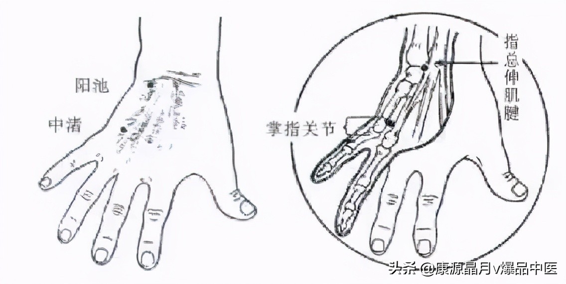 常用关节腔穿刺方法技巧大全