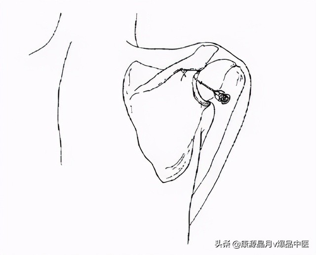 常用关节腔穿刺方法技巧大全