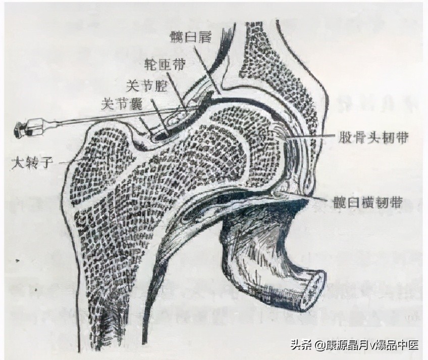 常用关节腔穿刺方法技巧大全