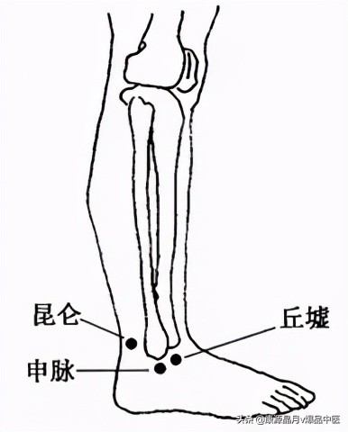 各种痛症的针灸治疗大全