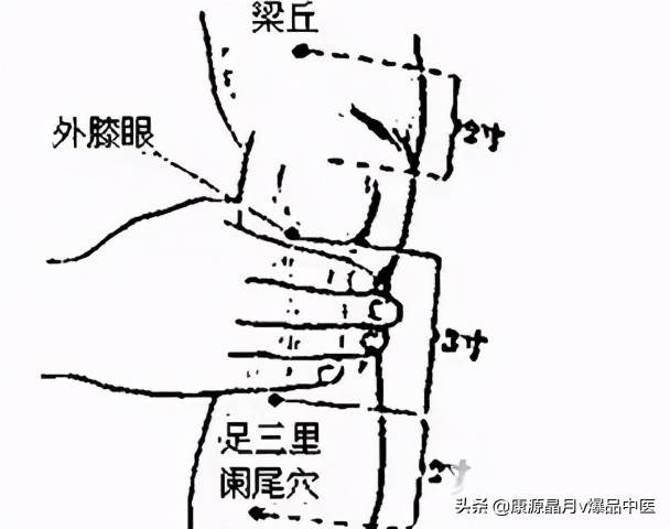 各种痛症的针灸治疗大全