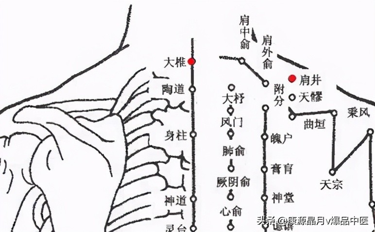 各种痛症的针灸治疗大全