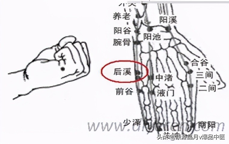 各种痛症的针灸治疗大全