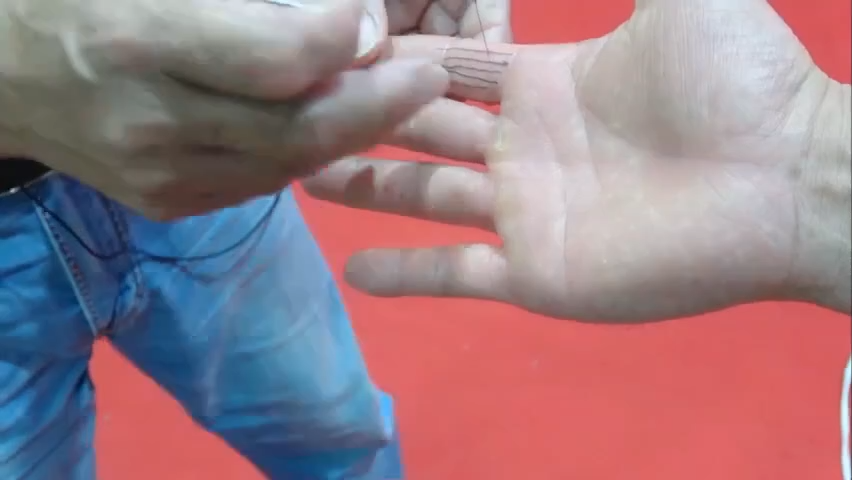 大小浮间，泌尿/呼吸同治，操作细节首发，速看！！