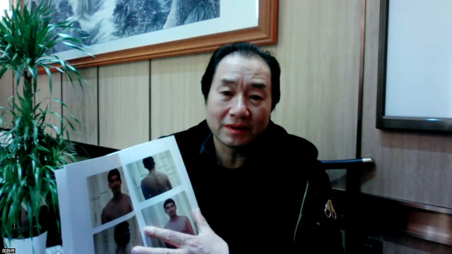 踝关节扭伤，如何才能不反复，答案公开！