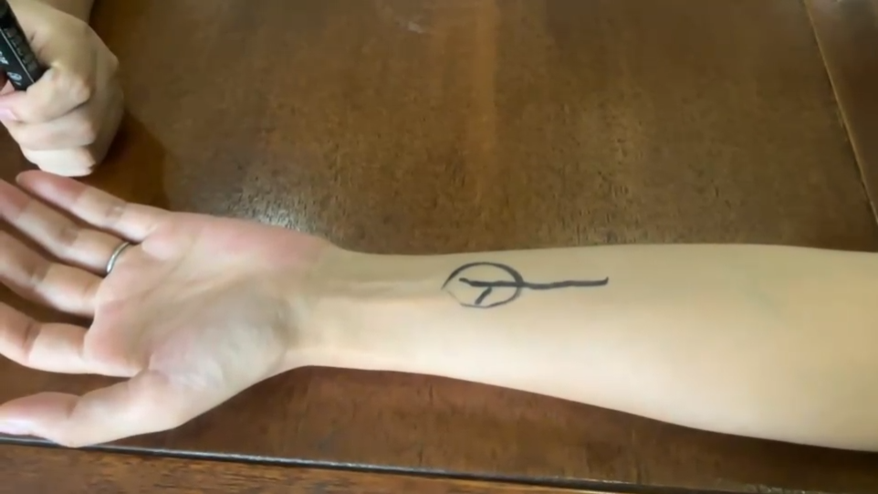 这个部位有这种变化，一定要注意！