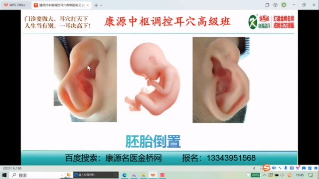 这条沟，千万别误诊！