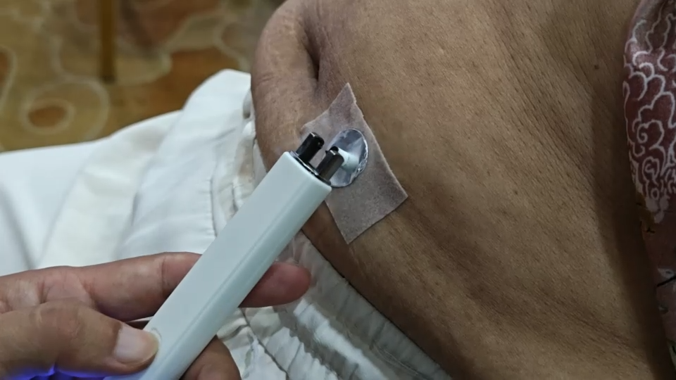 便秘，这三个穴位，交替使用！