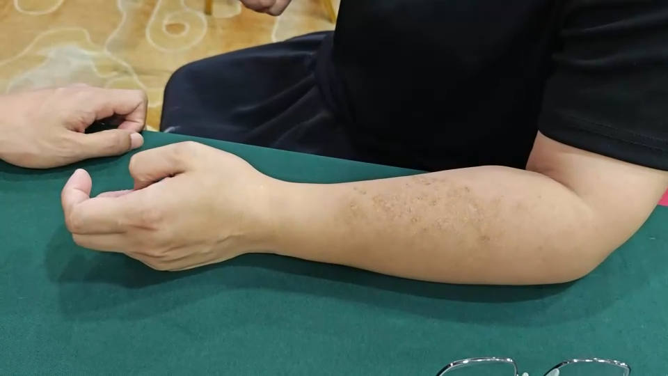 这组穴位，上下同治，超好用！