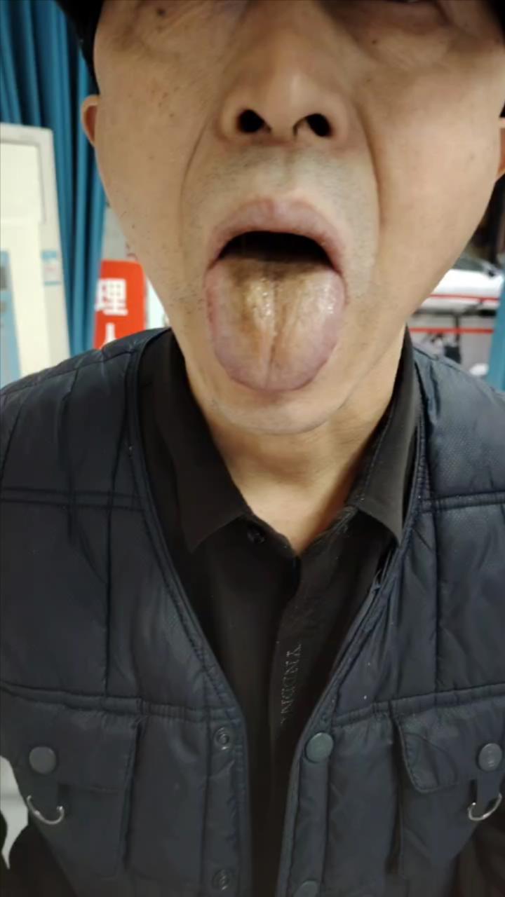 全身疼痛，患者要求配几天药带回家