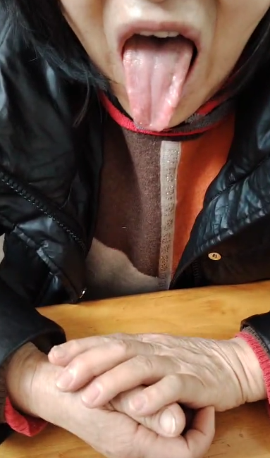 口腔溃疡小药粉